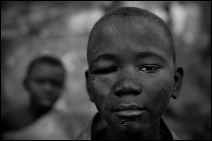 Childhood Traumatic Grief